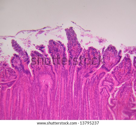Stomach+Tissue Stomach Tissue, Microscopic Stock Photo 13795237 : Shutterstock
