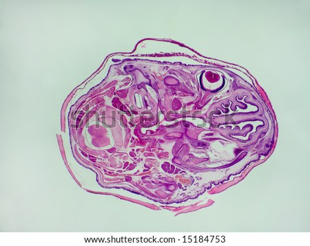 A transverse section of an entire embryo mouse head stained and mounted for microscopic examination.  Structures such as the nerve stem and eye are clearly visible.