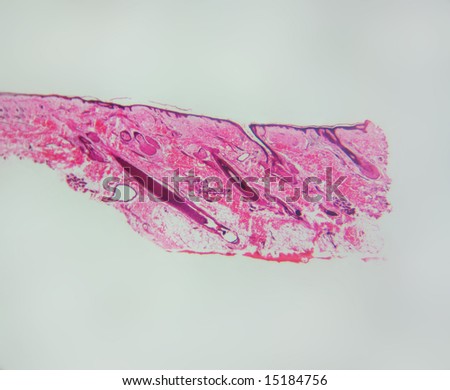 A microscopic image of cross section of human skin showing hair follicles, stained and mounted for microscopic examination