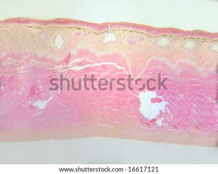 Frog skin-microscopic cross section.  Several mucous glands, one showing a prominent duct, are easily seen.