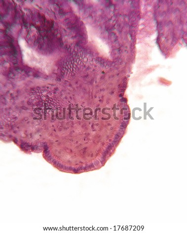 Gall bladder, microscopic demonstrating columnar epithelium