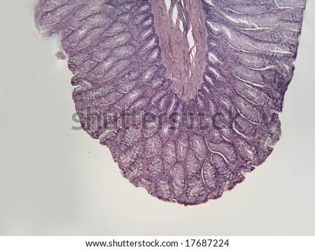 A microscopic cross section of the wall of a mammalian large intestine