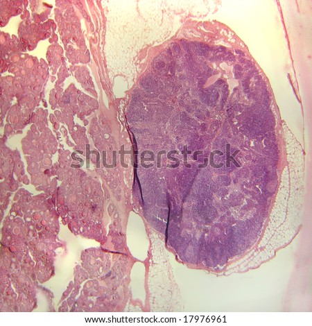 A microscopic cross section of mammalian tissue showing the parathyroid gland nestled up against the larger mass of thyroid gland tissue on the left