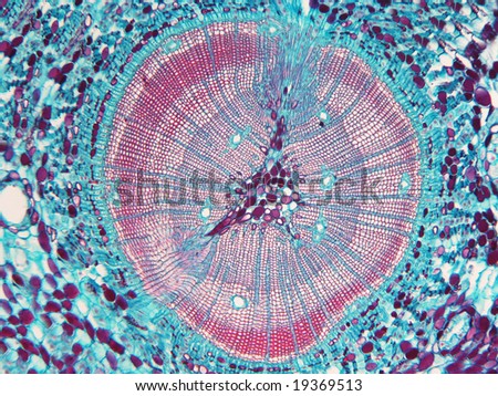 pine stem, stained and mounted for microscopic observation, magnified 100X