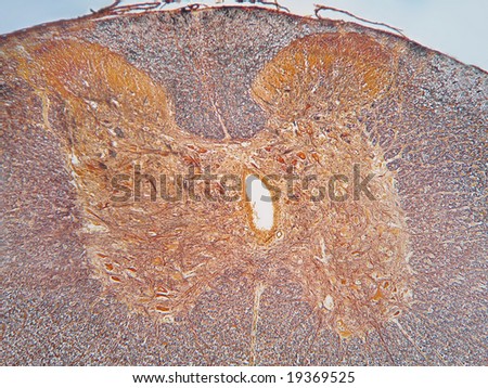 A portion of the spinal column, cross section 100X, silver stain