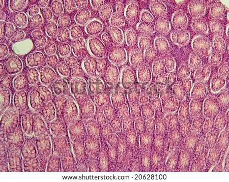 Large intestine villi cross sectioned showing goblet cells_100X_CS0187