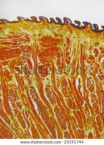 A section of human tongue showing muscle layers and surface papillae.  Magnification 40X