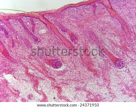 A portion of the human lip showing hair follicles and lower muscle layer