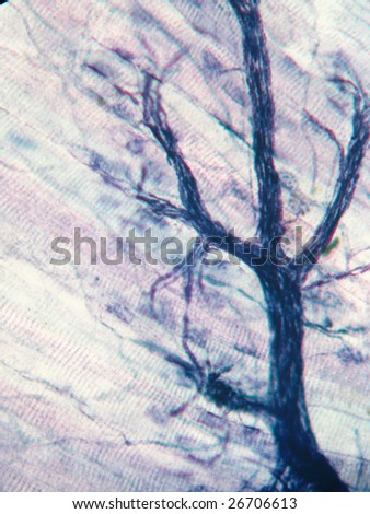 Nerve cell endings in skeletal muscles.  Magnification 200X