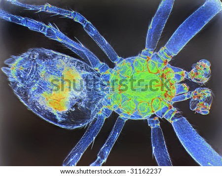 Small spider whole mount.  This image has been enhanced with a Density Color Conversion algorithm to accentuate internal structure.  Magnification 40X