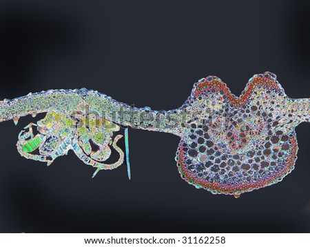 Fern leaf midrib and spore sorus. This image has been enhanced with a Density Color Conversion algorithm to accentuate internal structure.  Magnification 40X