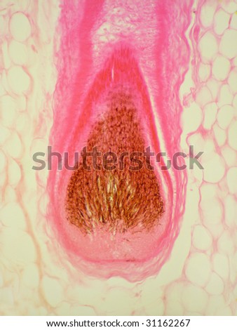 The root of a hair follicle.  Magnification 200X