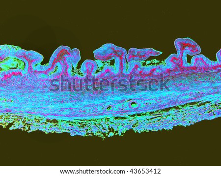 Villi and longitudinal epithelium of the gall bladder.  Image enhanced.  Magnification 40X