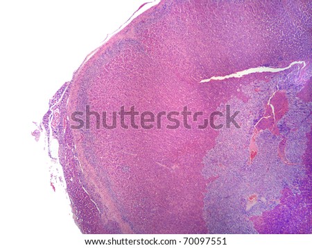 Adrenal gland tissue.  Magnification 40X