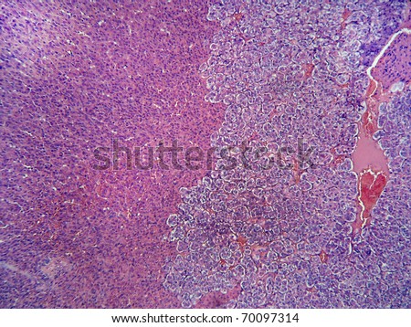 Adrenal gland tissue.  Magnification 100X