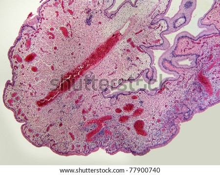 The decidua is the uterine maternal lining of the placenta during pregnancy.  This view shows the columnar epithelial cells, the stromal cells, and the abundant vascularization of this tissue.  40X