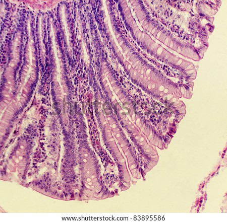 Large intestine, cat, showing villi, goblet cells, and other significant structures.  Magnification 200X