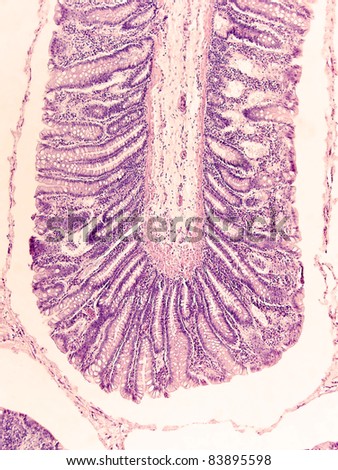 Large intestine, cat, showing villi, goblet cells, and other significant structures.  Magnification 100X