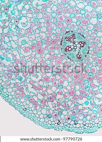 Cross section of the center of a buttercup (Ranunculis) root.  Magnification 100x