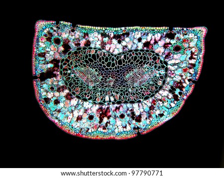 A cross section of a pine leaf (needle) showing various leaf structures such as resin ducts, stomata, vascular bundles, and other structures.   Image enhanced.  Magnification 100x