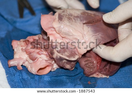 muscle structures found in structures of heart. muscle structures found in