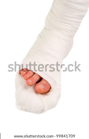 leg in a plaster cast on a white background