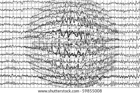 brain wave encephalogramme EEG isolated on white background
