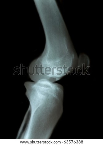 Knee Pathology
