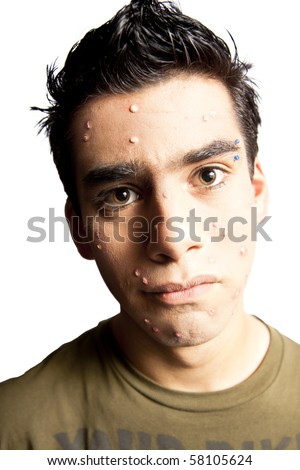 How you picture posters in your mind - Page 3 Stock-photo-photo-of-teenager-with-acne-58105624