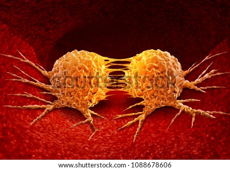 Dividing cancer cell metastasis division as a disease anatomy concept as a growing malignant tumor on an organ inside the human body as a 3D illustration.
