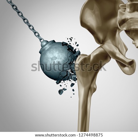 Strong bones and healthy human bone orthopedics and strength in mineral density medical concept as a wrecking ball destroyed by osteoporosis prevention medicine symbol as 3D illustration.