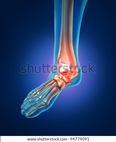 Foot pain with a skeleton of the walking body part with bones in red where there is inflammation of the ankle  that has an orthopedic joint injury caused by bad shoes or running accident.