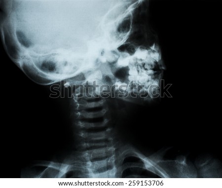 x-ray of human body parts