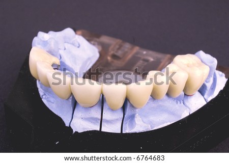 Dental bridge at laboratory - object