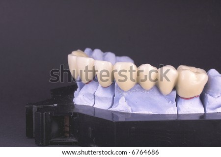 Dental bridge at laboratory - object