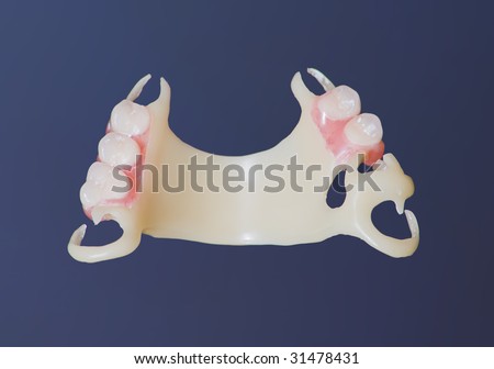 partial, acetal denture at labolatory