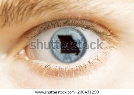 A close-up of an eye with the pupil in the shape of Missouri.(series)