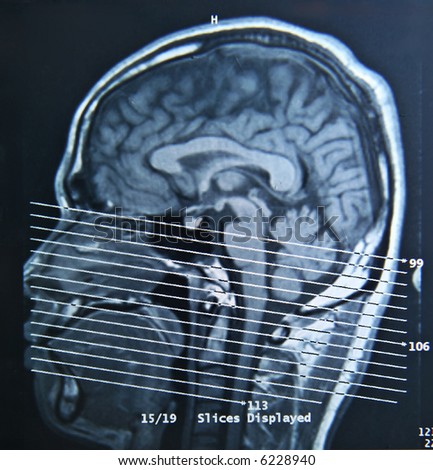 A magnetic resonance imaging scan of the human brain.