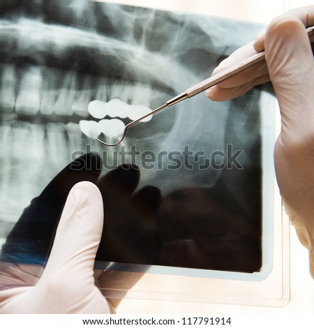 Panoramic dental X-Ray in hand Panoramic dental X-Ray in hand