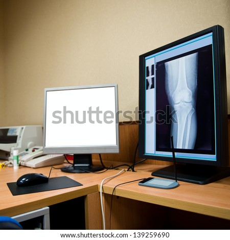 X-rays viewed on hospital monitors.