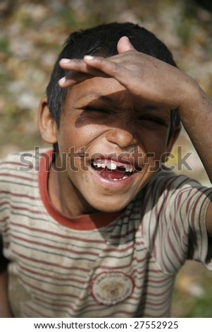 ANNAPURNA, NEPAL – APRIL 3 : A young boy with snotty nose, scabs and missing tooth in Annapurna, Nepal April 3, 2008. Annapurna trail is well known for its trekking activities.