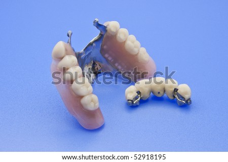 Combined fixed and mobile prosthesis with milling and micro connection on a blue background