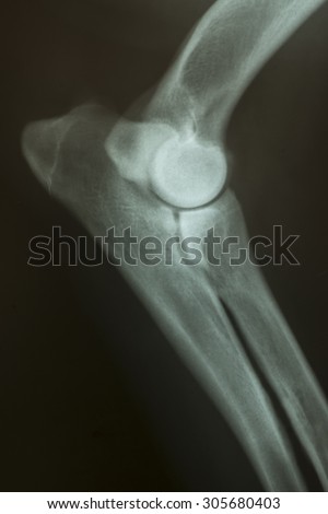 X-ray photo of a normal elbow of a dog