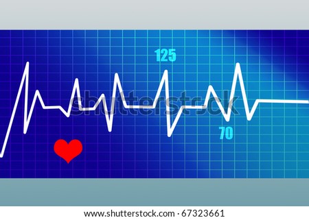 heart beat graph with indication of blood pressure high and low
