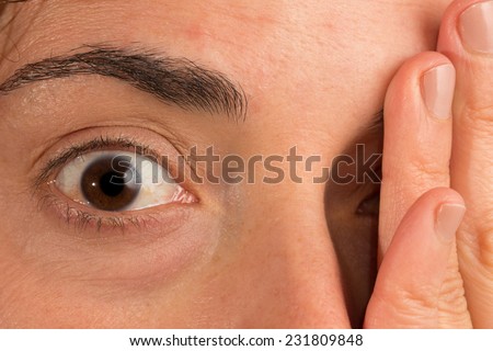 Closeup of caucasian woman open right eye and hand over left one