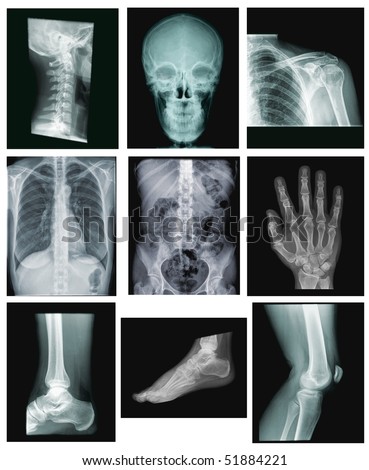 collection of x-ray images: spine, skull, shoulder, chest, belly, hand, ankle, foot, knee