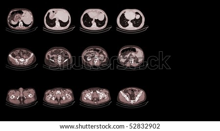 computed tomography of a human body isolated on black background