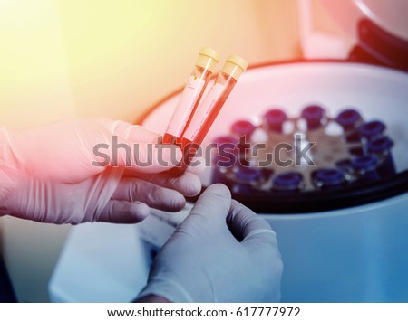 Platelet-Rich plasma preparation. Tube with blood in hands. Centrifuge. Background