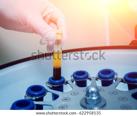 Platelet-Rich plasma preparation. Tube with blood in hands. Centrifuge. Background