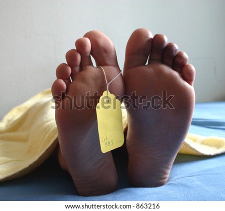 dead feet